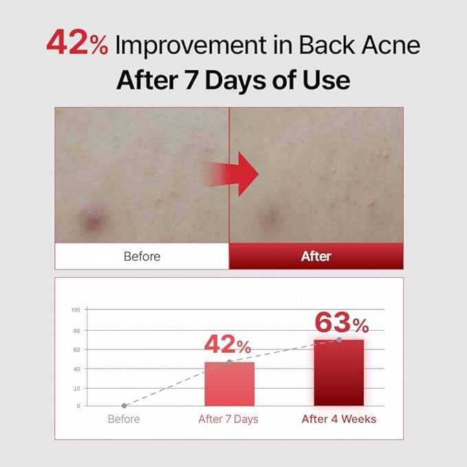 Acne Blemich Body Wash 460ml/15.55fl.oz. NODOR Acne-Prone Skin Soothing Care Redness Relief Gentle Low-Irritation pH-Balanced Fresh Rosemary Herbal Scent Korean body care