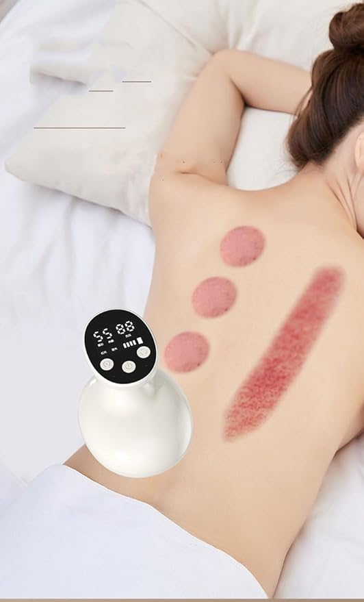 Electric Cupping Therapy Massager Machine Electric Cupping Massager for Body Reduce Muscle Pain Handheld Suction Massager with Adjustable