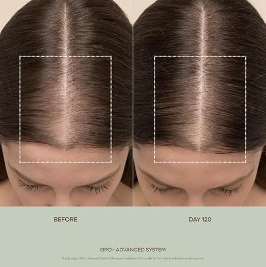 VEGAMOUR GRO+ Advanced Balancing Shampoo | Lightly Exfoliates Cleanses and Removes Buildup Without Stripping | For Severe Signs of Thinning | Color Safe Vegan Cruelty-Free (8 Fl Oz)