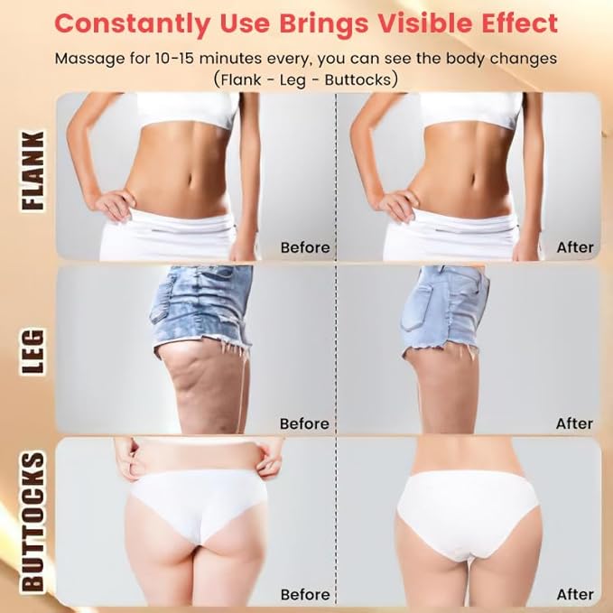 Drainage Massager &amp Anti Cellulite Massage ToolFascia Blaster for CelluliteHelps Reduce Stretch Marks for Legs Arms &amp BellyBody Sculpting Machine with Microcurrent Light Vibration