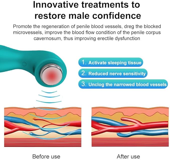 Portable Silent Shockwave Therapy Machine Effective Electromagnetic Extracorporeal E-D Shock Wave Therapy Machine Pain Relief Body Massager Muscle Relax Massage Gun