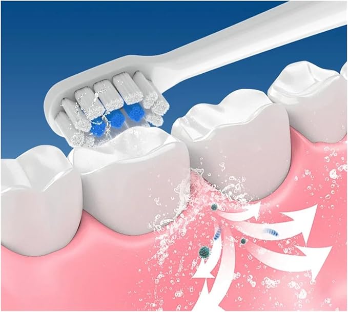 Replacement Brush Heads Compatibility for Mijia T301 T302 T501 /501CSonic Toothbrush Head Soft Bristle Nozzles(T301-302-WH-12Pcs)