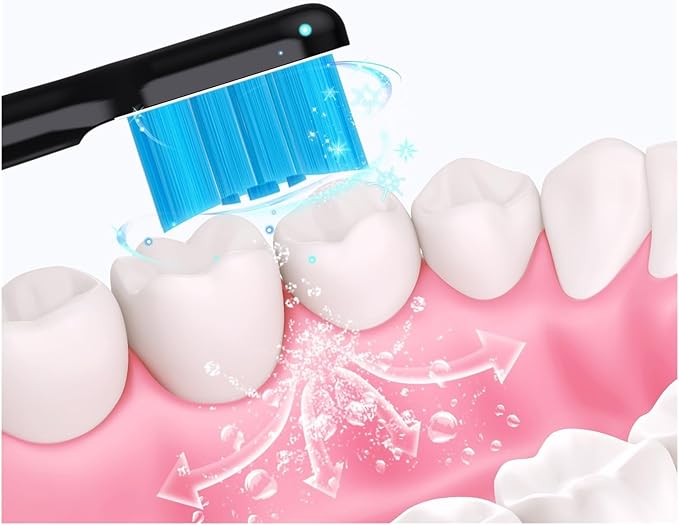 Compatible with Sonic Electric Toothbrush Replacement Heads with 10(Black)