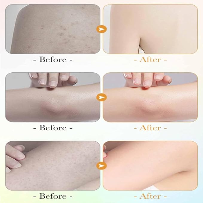 Vitamin C &amp Lemon Niacinamide Body WashNatural Vitamin C Nourish Rejuvenation Body WashDeep Cleansing &amp Nourishingfor all Skin Types (1PCS)