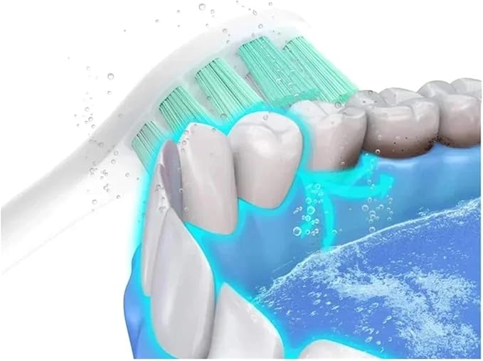 Replacement Toothbrush Heads Compatible for T301/T302/T501 Electric Tooth Brush Bristle Nozzles with Packaging(20 White)