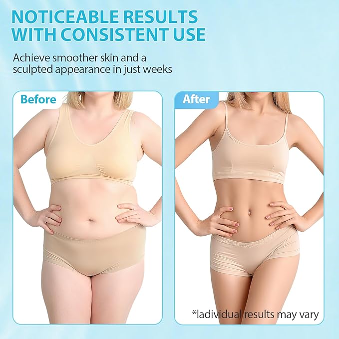 Body Sculpting Machine 3-in-1 Electric Cellulite Massager Electric Cupping Therapy Massagerfor Belly Waist Arms Leg Home ToolEffectively Tightens the Skin