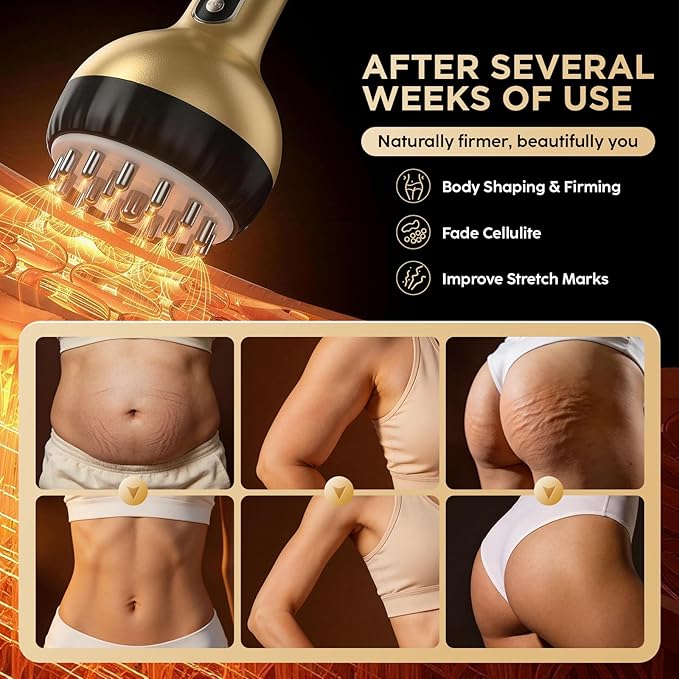 Lymphatic Drainage Massager &amp Anti-Cellulite Massage Tool Body Sculpting Device for Legs Arms &amp Stomach Supports Smoother Skin with Gentle Warming &amp Vibration - Gold