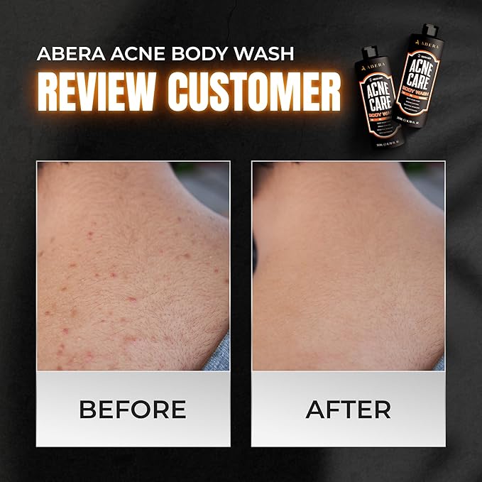 ABERA Men Body Wash with AHA BHA Niacinamide &amp Witch Hazel – Deep-Cleansing Shower Gel for Oily Skin and Smoother Texture – Refreshing Scent – 11.83 fl oz