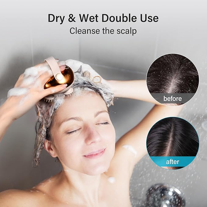 arboleaf Electric Scalp Massager Head Massager Scalp Stress Relax 5 in 1 Kneading 128 Massage Nodes Waterproof Hair Massage with 8 Removable Claws Cat Scratcher Gift for Dad Mom