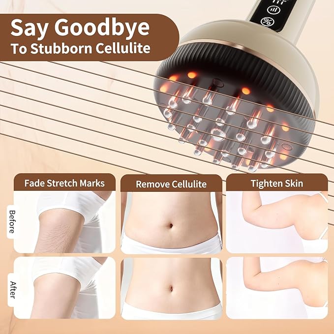 Lymphatic Drainage Massager Handheld Cellulite Massage Tool with Red Light Heat &amp Vibration | Multifunctional Lymphatic Drainage Tool for Belly Legs Hand Arms Skin Tightening &amp Relaxing Ma