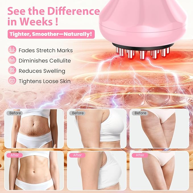 Lymphatic Drainage Massager Anti Cellulite Massage Tool For Thigh &amp Belly Stretch Marks &amp Cellulite Reduction Handheld Massage tools for Sciatica Nerve Legs Arms Hip Muscle Low Back Pai