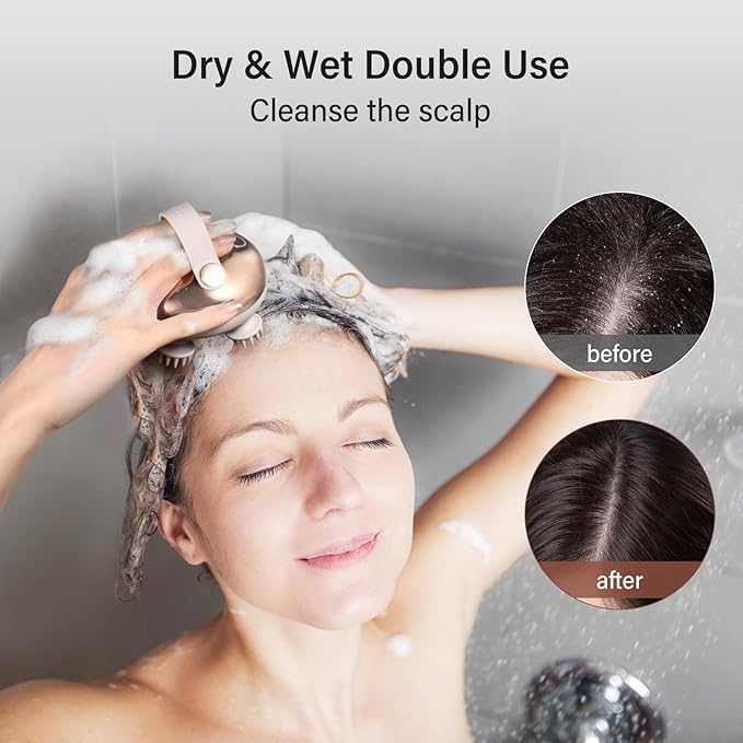 arboleaf Scalp Massager Kneading Head Massager Scalp Stress Relax Portable Rechargeable Hair Massager Shower Massage Waterproof Cat Massager ScratcherGift for Mom Dad