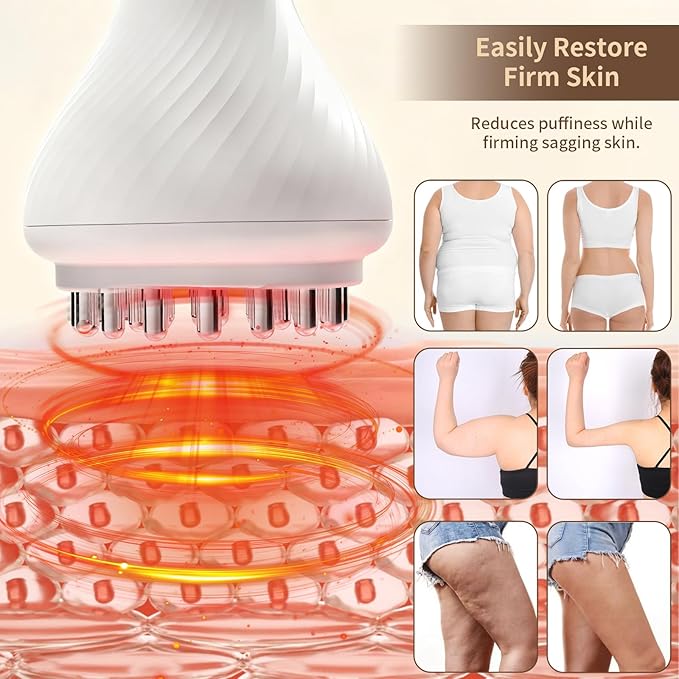 Body Sculpting Machine Lymphatic Drainage Massager &amp Anti Cellulite Massage Tool Helps Reduce Stretch Marks &amp Cellulite Pain Relief Devices for Legs Arms &amp Belly Body (White)