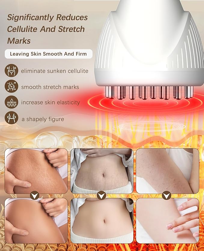 Lymphatic Drainage Massager Helps Reduce Stretch Marks &amp Cellulite 12 Level Anti Cellulite Massage Tool &amp Body Sculpting Machine with Light Therapy Heat &amp Vibration for Legs Arms Belly