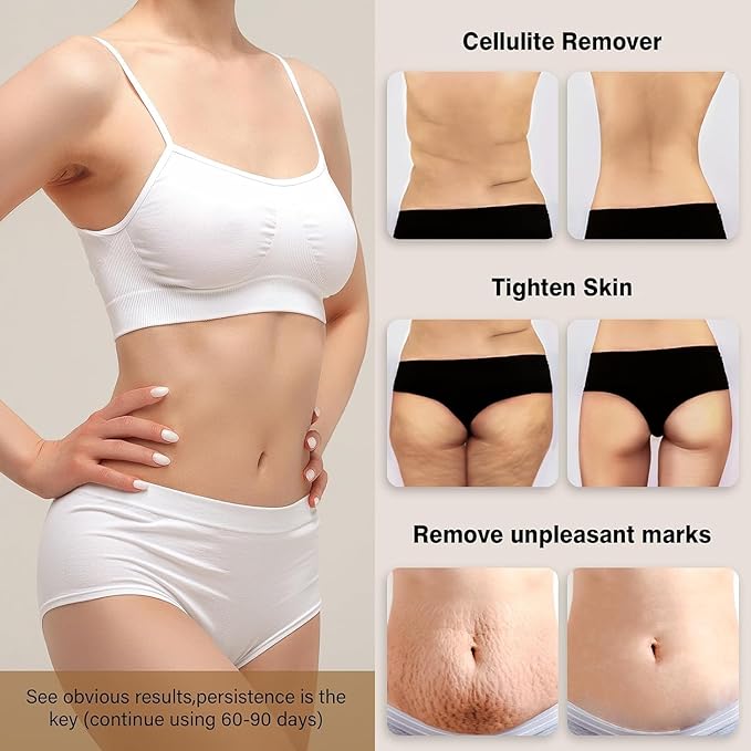 Cellulite Massager Tool Body Sculpting Machine 4 in 1 Body Sculpting Tool with Heating Skin TighteningCordless Electric Handle Massager Cellulite Remover for BellyWaistArmsLegsetc(White)