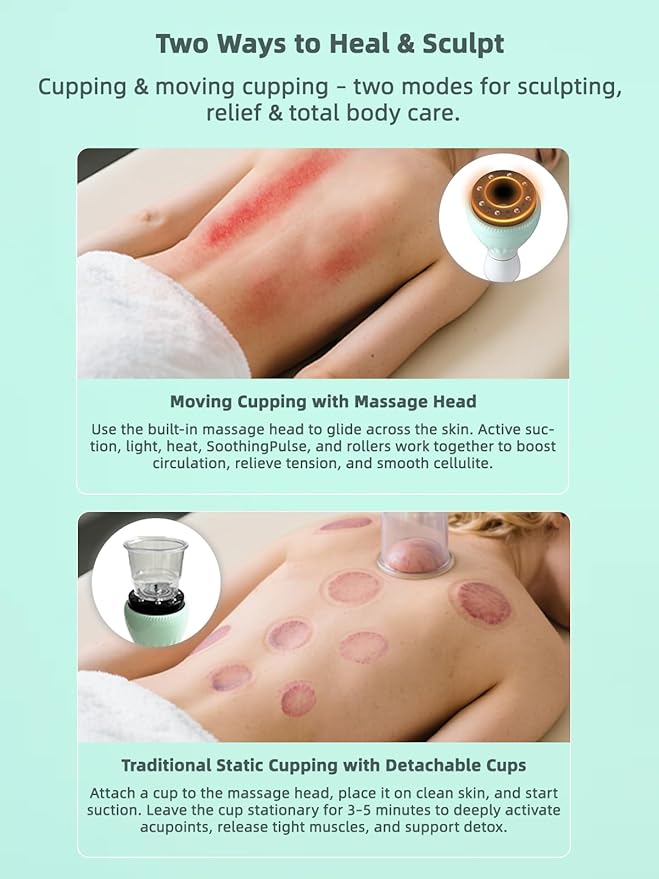 Electric Cupping Kit for Massage Therapy with Heat – Cellulite Massage Tool Lymphatic Drainage Massager Pain Relief for Back Neck &amp Shoulders – Moving &amp Static Cupping Set for Body Sculptin