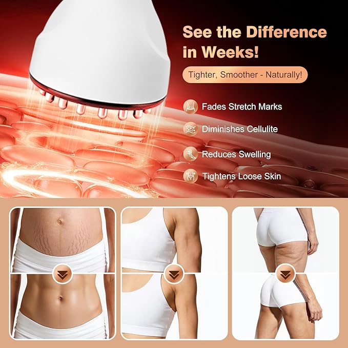 Lymphatic Drainage Massager 4-in-1 Anti-Cellulite Massager Tool Body Sculpting Machine for Microcurrent Light Heat &amp VibrationSuitable for Abdomen Arms Back &amp LegsHelps Reduce Stretch M