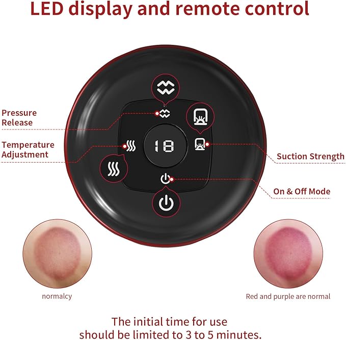 5-in-1 Smart Dynamic Cupping Therapy Massager Set 12 Levels Heat &amp Suction Cupping Kit for Massage Therapy Electric Cupping Device with Red Light Therapy for Back Pain Knots Muscle Soreness (R