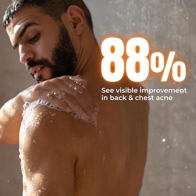 ABERA Men Body Wash with AHA BHA Niacinamide &amp Witch Hazel – Deep-Cleansing Shower Gel for Oily Skin and Smoother Texture – Refreshing Scent – 11.83 fl oz
