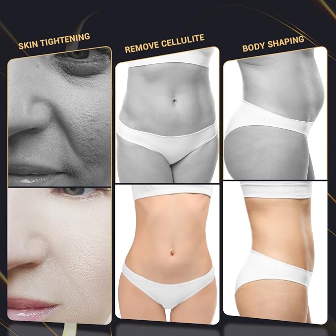 Body Device for Massage Temporary Reduction in The Appearance of Cellulite Multifunctional Cellulite Remover for Whole Body