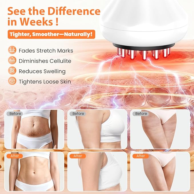 Body Sculpting Machine Lymphatic Drainage Massager &amp Anti Cellulite Massage Tool Helps Reduce Stretch Marks &amp Cellulite Targeted Relief for Sciatica Nerve Hip Joint &amp Muscle and Lowe