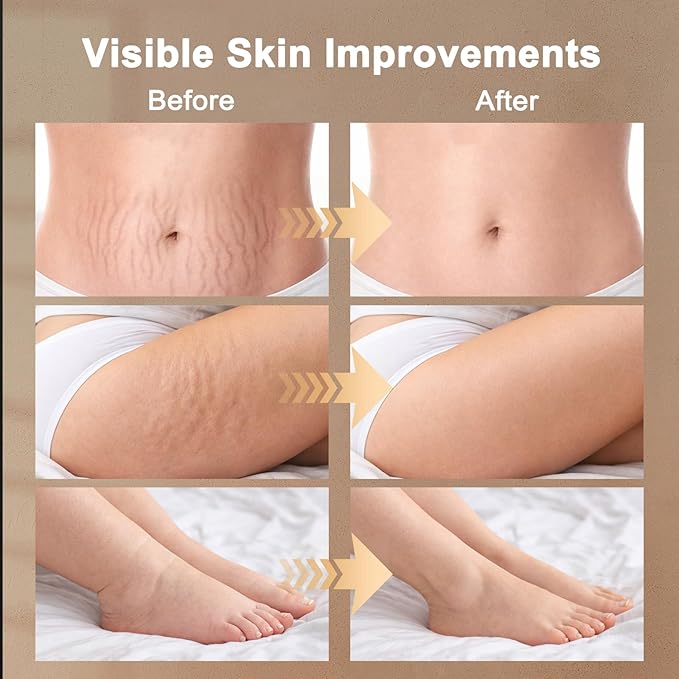 Lymphatic Drainage Massager Lymphatic Massager Helps Reduce Stretch Marks &amp Cellulite for Legs Arms &amp Belly Body Sculpting Machine with Microcurrent Light Heat &amp Vibration White