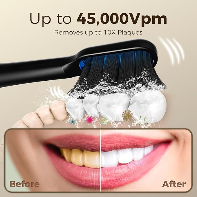 ARPHA Sonic Electric Toothbrush for Adults Power Whitening Toothbrush with Holder Wall Cup 2 Brush Heads &amp Travel Case 45000 VPM Electric Motor &amp Wireless Charging 3 Modes w Smart Timer