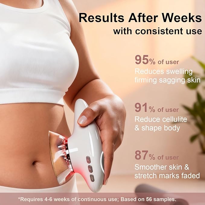 Body Sculpting Machine 4 in 1 Cellulite Remover for Legs Adjustable Cellulite Massage Tool Home Use Cupping Therapy Tool for Belly Waist Arms Legs and Face (Beige)