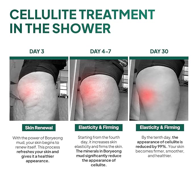 Anti Cellulite Mud Scrub Body Wash Gentle Exfoliating Improves Skin Texture Provides a Smoother Look 5.07 Fl Oz (1)