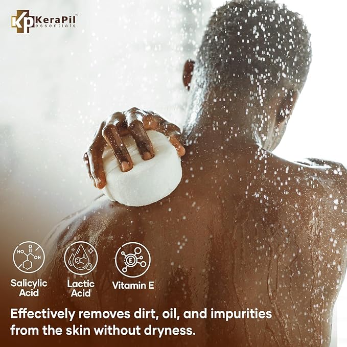 Exfoliating Body Wash with Salicylic Acid - No Dry Out Gentle Exfoliates Rough and Bumpy Skin Body Acne Wash BHA &amp AHA - Coconut and Vanilla Salicylic Acid Body Wash - (16 fl oz x 2)