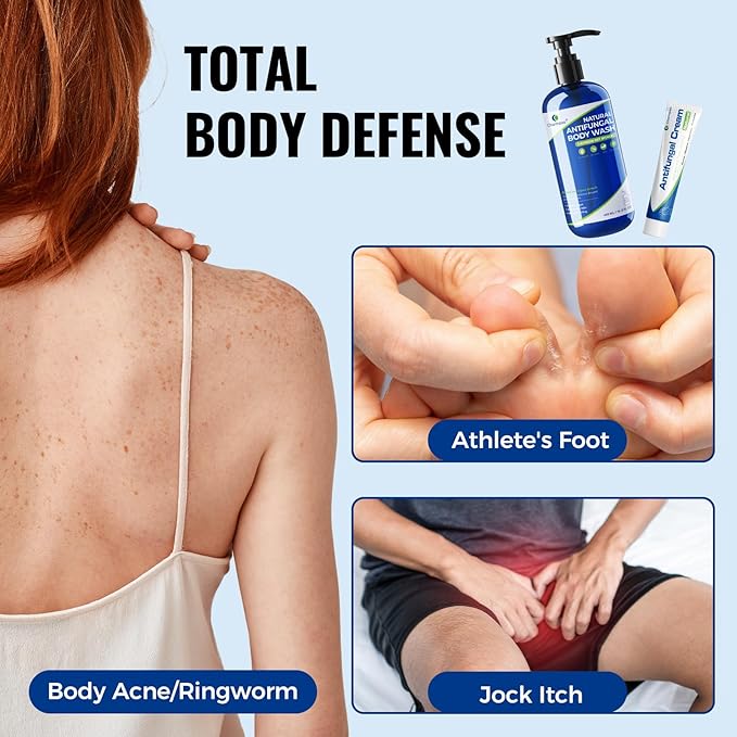 Ultimate Antifungal Bundle: Tea Tree Body Wash (16.3oz) + Miconazole Antifungal Cream (2 Pack) - Complete Treatment Kit for Athlete’s Foot Jock Itch Ringworm Body Odor &amp Eczema - Soothes I