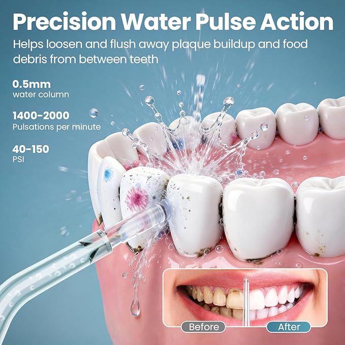Onlyone Water Dental Flosser Pick for Teeth 300ML Portable Oral Irrigator Rechargeable Travel Irrigation Cleaner Professional Electric Flossing Machine Birthday Gifts for WomenMomGirlfriend Pink