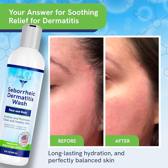 Seborrheic &amp Atopic Dermatitis Gentle Face Wash with Manuka Honey - Natural &amp Organic Face Cleanser &amp Body Wash For Sensitive Skin - Hypoallergenic Paraben Free &amp Sulfate Free Acne Fa