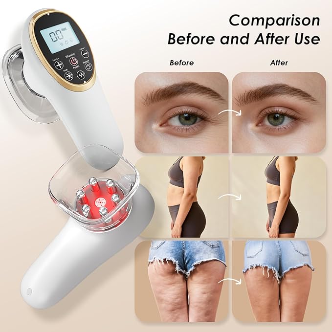 AAQ 4-in-1 Body Sculpting Machine - Professional Cellulite Massage Tool with Lymphatic Drainage &amp Skin Tightening Body Sculptor for Back Abdomen Waist Arms Legs and Buttocks-White