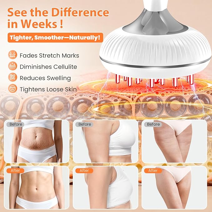 Lymphatic Drainage Massager Anti-Cellulite Massager For Body Cellulite and Thigh &amp Belly Stretch Marks Reduction Handheld Massage tools for lymphedema &amp lipedema Sciatica Nerve pain relief