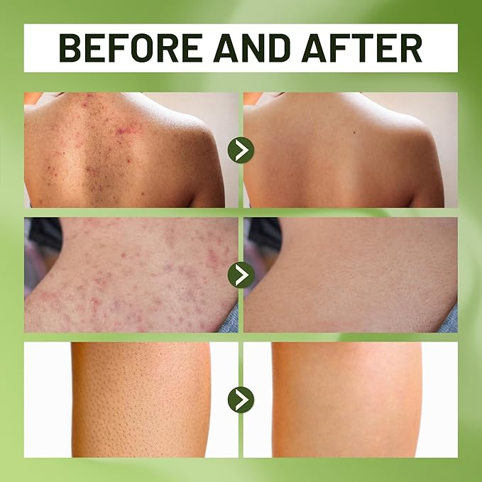 ABERA Folliculitis Body Wash and Grapefruit Hair Regrowth Serum