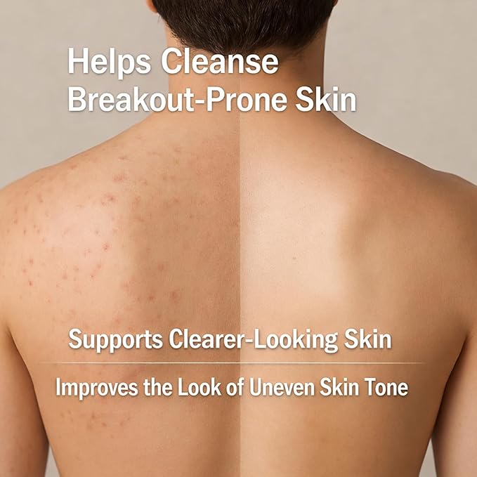 Men's Acne Body Wash Acid Body Wash for Back Chest &amp Shoulders with Niacinamide Glycolic Acid &amp Ceramides 8.5 fl oz