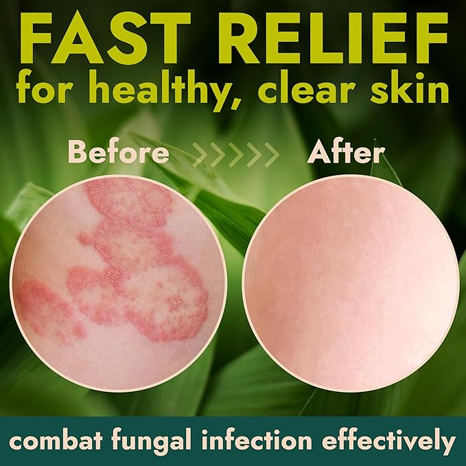 Antibacterial Body Lotion | Kills 99.9% of Germs &amp Bacteria | Body Lotion for Women &amp Men Helps Sanitize Skin | Infused with Botanical Extracts | Fresh Soft &amp Moisturized Skin | 4 fl oz