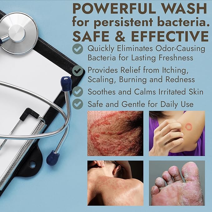 Antibacterial Body Wash | Antibacterial Soap for Men &amp Women | Kills 99.9% of Germs &amp Bacteria | Helps with Back Acne Body Odor &amp Skin Irritation | Manuka Honey &amp Charcoal 16 fl oz