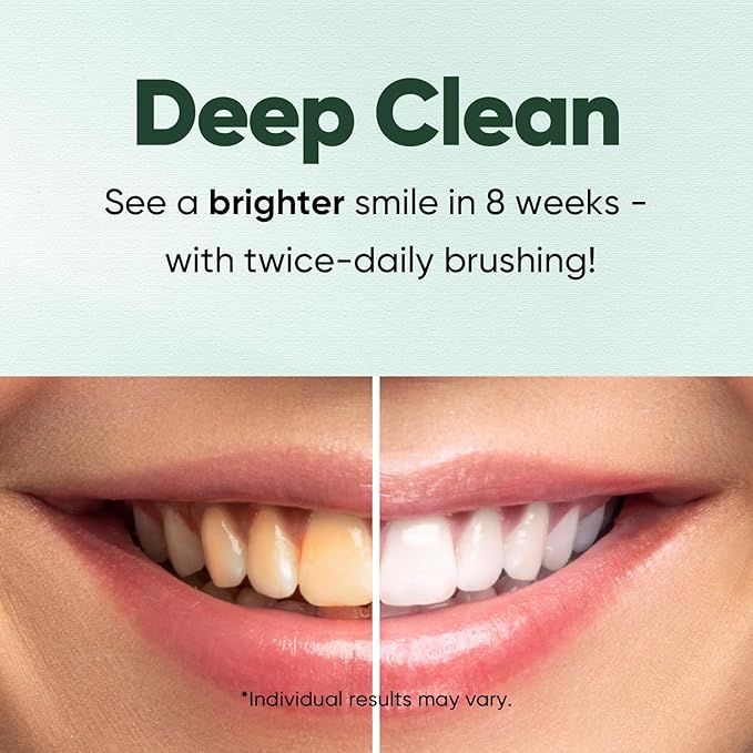 MySmile DY156 Electric Toothbrush nHA Toothpaste