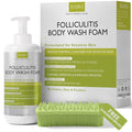 Folliculitis Treatment Folliculitis Body Wash Sensitive Skin | Foaming Cleanser for Redness &amp Irritation with No Sulfates Dyes or Parabens | Body Wash Includes Bonus Scrubber Brush
